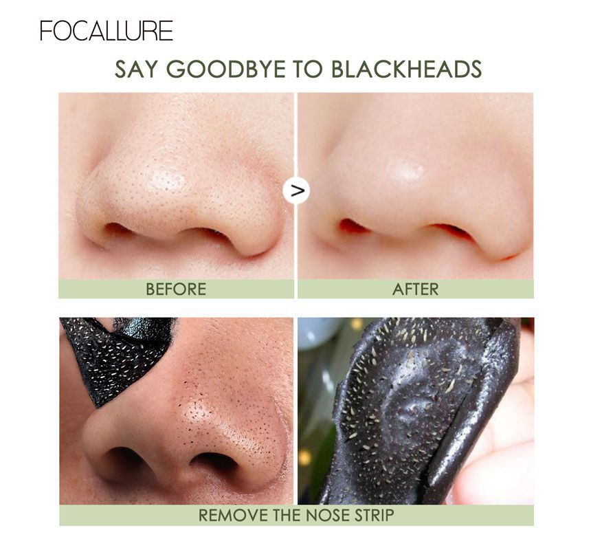 Black Head Remover Pore Strips SpreePicky