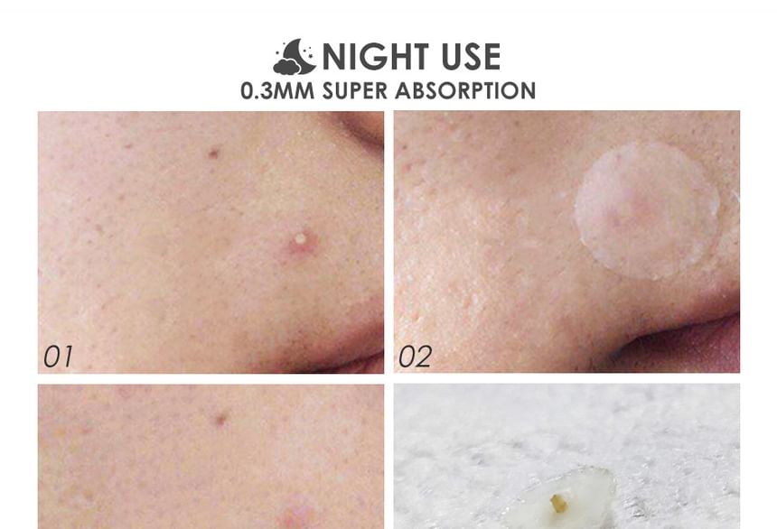 Acne Pimple Patch SpreePicky