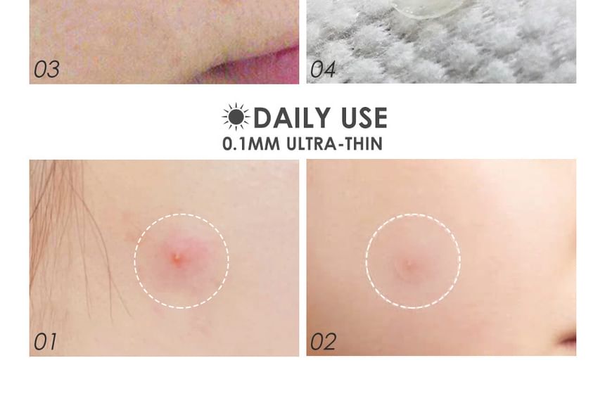 Acne Pimple Patch SpreePicky